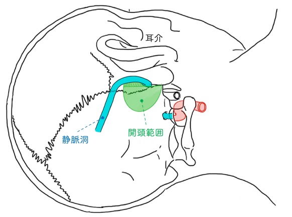 顔のけいれん・痛み・ぴくつき